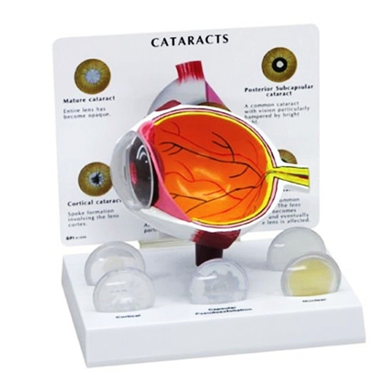 4X Human PVC Eye Cataract Anatomy Teaching Model