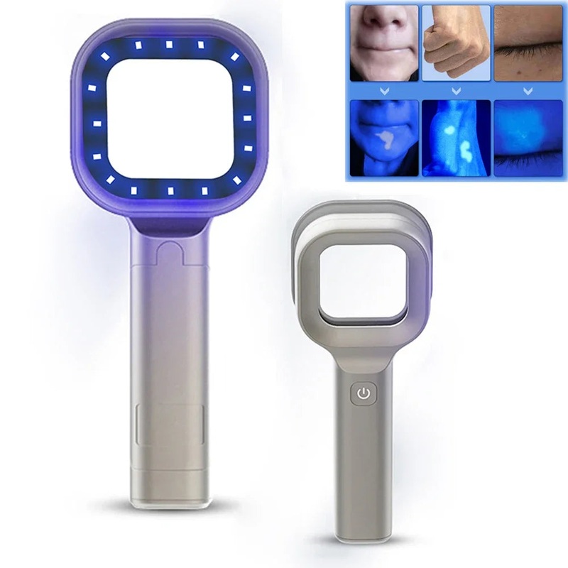 New Skin Analyzer With Woods Lamp Portable Vitiligo Detector Skin Analysis Machine Rechargeable Skin Detection Wood Light Lamp