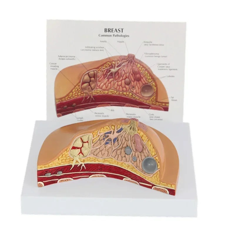 1:1 Median Section Model of Human Female Breast Pathology Anatomy Model Kit Table-type breast lesion model lactating breasts