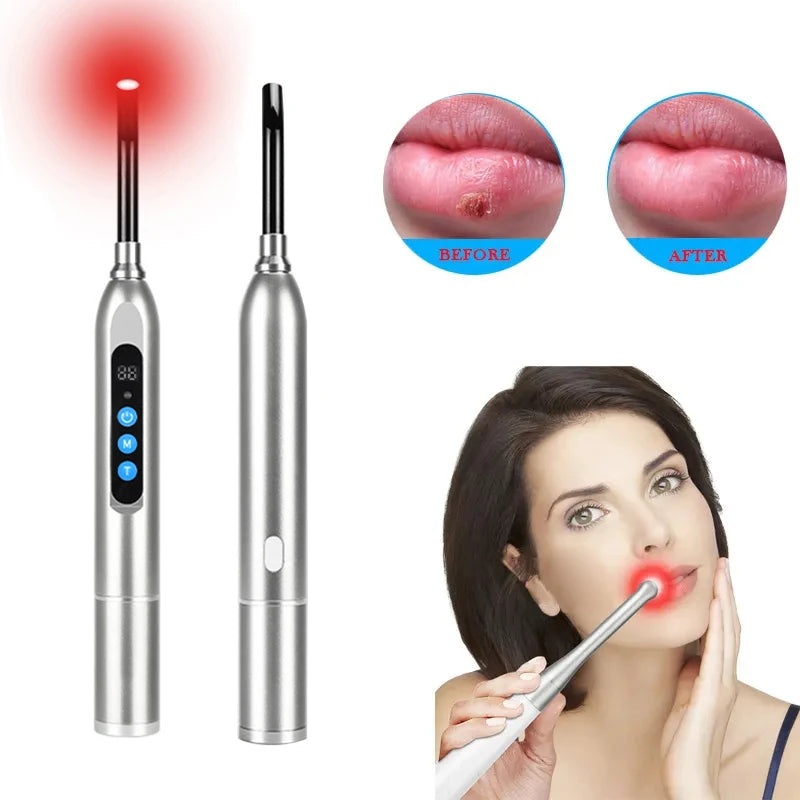 Red Light Therapy Device Wireless LED Near Infrared Cold Sore And Canker Sore Light Therapy Relief Pain Skin Care Beauty Wand