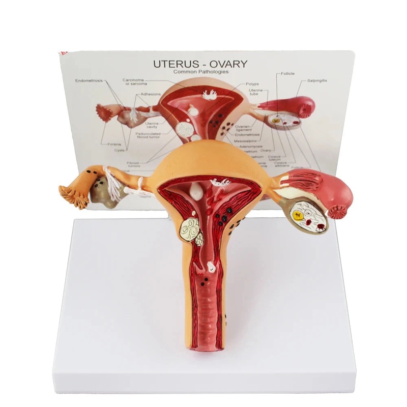 Uterus Model Female Reproductive Organs Anatomy Model Pathological for Anatomical Education from Forestedu