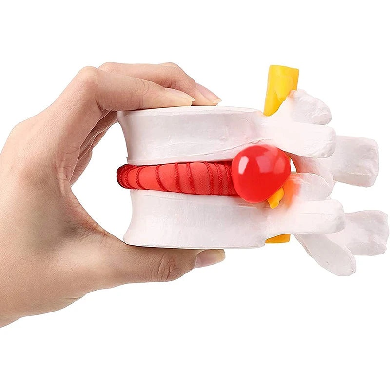 Lumbar Vertebral Model of Human Lumbar Intervertebral Disc Herniation Demonstration Model