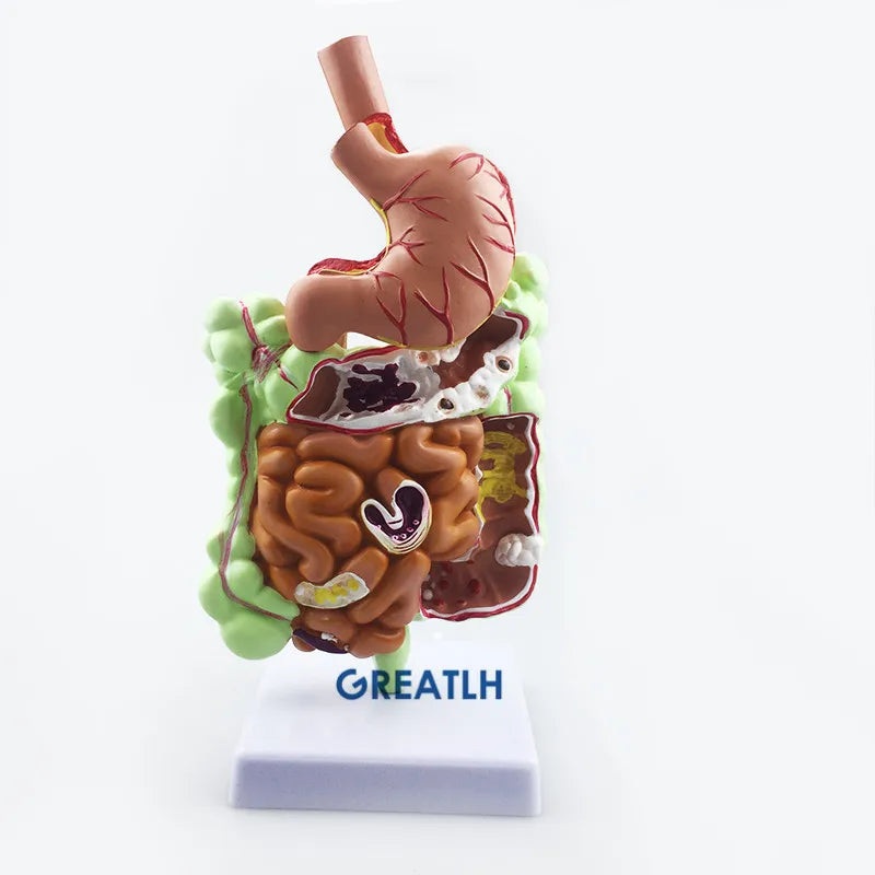 Stomach Large Intestine Cecum Rectal Anatomy Model Human Digestive System Teaching model