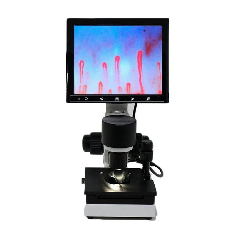 Digital Microscope Zoom Nailfold Capillary Microcirculation Detector Blood Microcirculation Analyzer with 7/8/9 Digital Screen