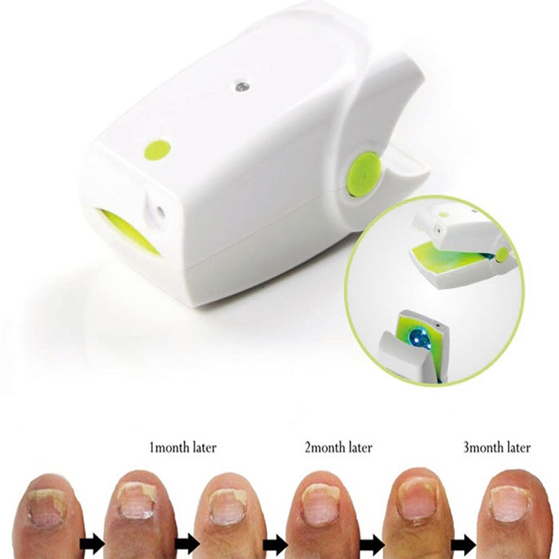 Highly Effective Rechargeable Nail Fungus Laser Device Nail Infection Onychomycosis Cure Nail Fungal Infections