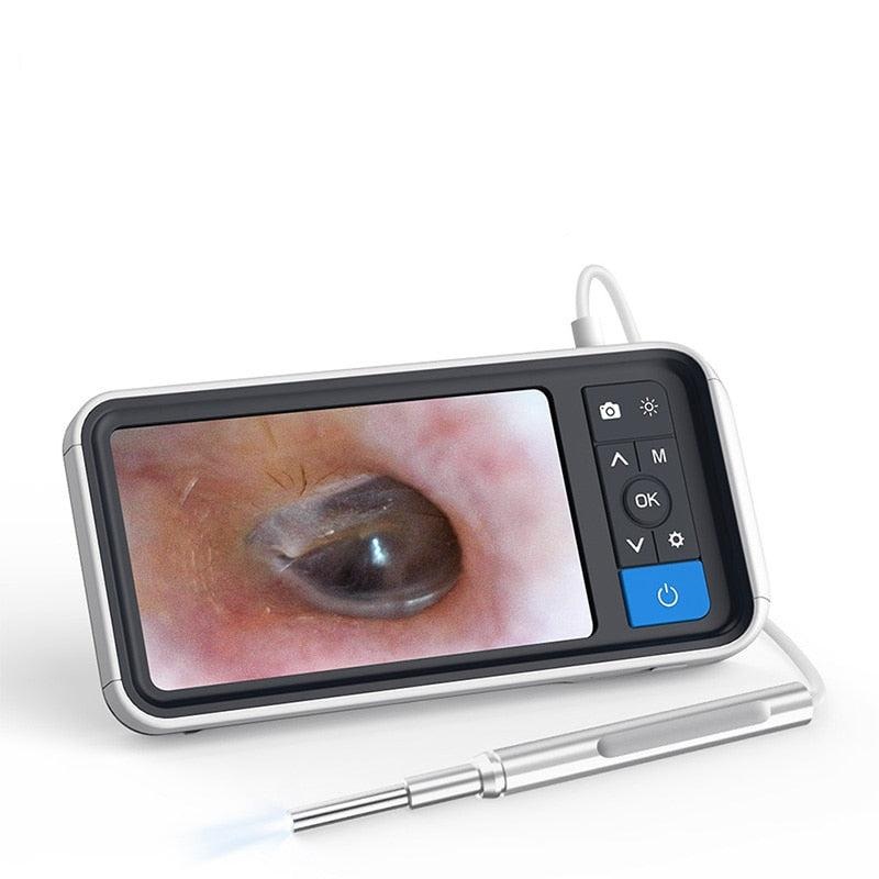 TESLONG MS450 3.9mm USB Otoscope with 4.5  Inch Display Ear Inspection Camera Ear Scope with 6 LEDs 1.0MP HD Ear Endoscope With 2500AMH