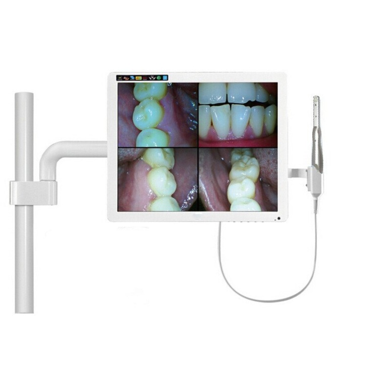 Dental Intraoral Camera USB 2.0 Dynamic 4 Mega Pixels 6-LED Dentist Intra Oral Camera endoscope