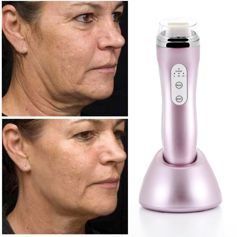 New Handy RF Skin Rejuvenation Therapy Mini Anti Aging Dot Matrix Skin Care RF Thermage Personal Care Beauty Device