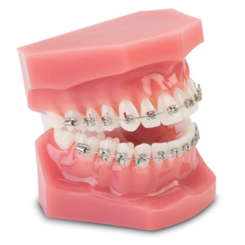 Orthodontic Demonstrator Model