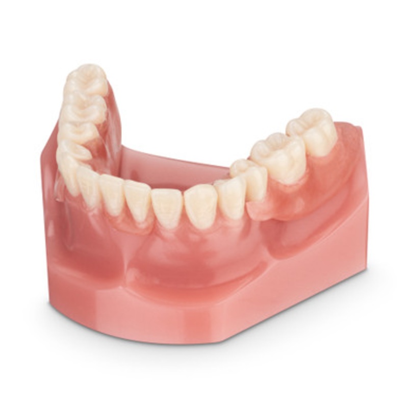 Flexible Lower Partial Denture Model