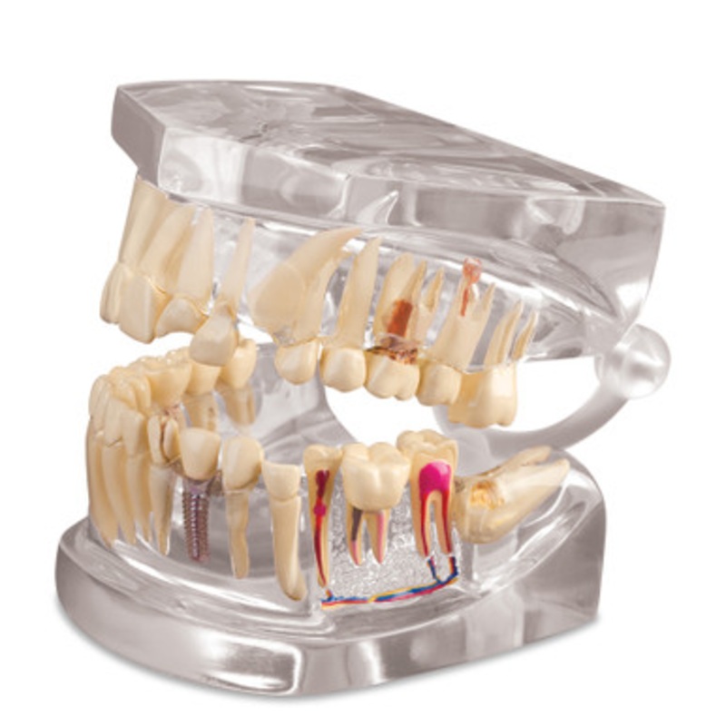 Clear Human Jaw Model