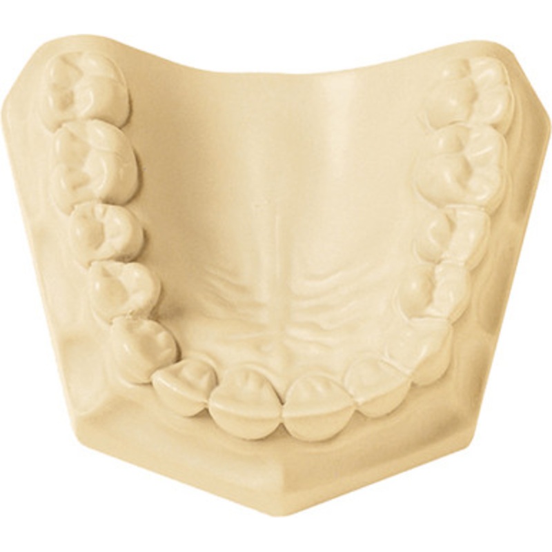 Resinrock 11 Lb. Carton 1/Pack