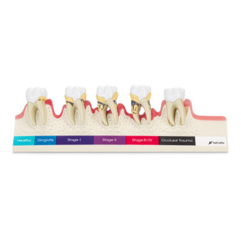 Periodontal Progressional Model